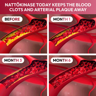 Nattōkinase Multivitamin