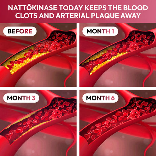 Nattōkinase Multivitamin
