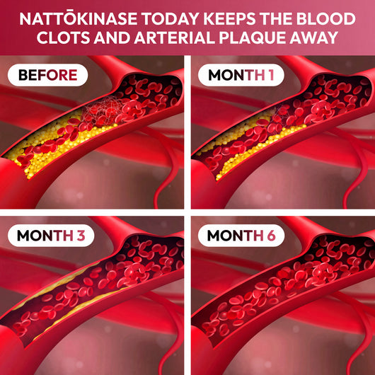 Nattōkinase Multivitamin